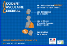Accident vasculaire cérébral : agir vite c&rsquo;est important !