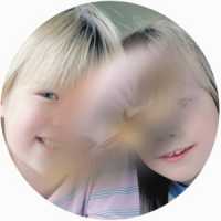 Avastin : la RTU dans la DMLA avance