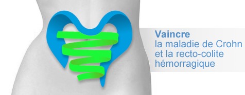 MICI : une étude pour comprendre le vécu des malades