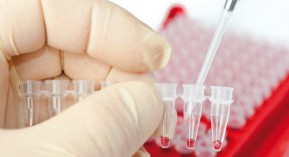 Pioglitazone : un retour pour traiter la leucémie ?