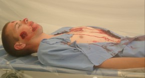 Victimes du terrorisme : la gratuité des soins précisée&nbsp;