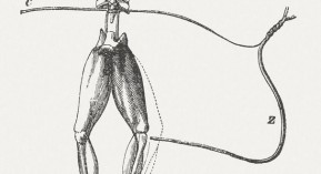 Médecine bioélectronique : Google s&rsquo;allie à GSK