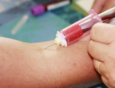 AVK : les infirmiers veulent être payés pour adapter les posologies