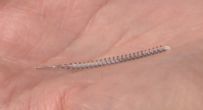 Implant contraceptif : Essure n’est pas Nexplanon