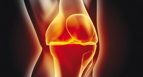 Déremboursement de l’acide hyaluronique dans la gonarthrose : les candidats à la présidentielle ont droit à leur lettre