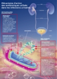 © ARMPL3171_C2_Infectionsurinaires.qcd-60-image_I4 - claire witt-deguillaume