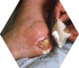 © ARMPL3190_C2_lesescarts.qcd-60-image_I1 - SIMON FRASER/BRAMPTON DAY HOSPITAL, CUMBRIA/SPL/PHANIE