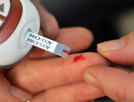 Dépistage du diabète en pharmacie : résultats d’une expérimentation dans le Grand-Est