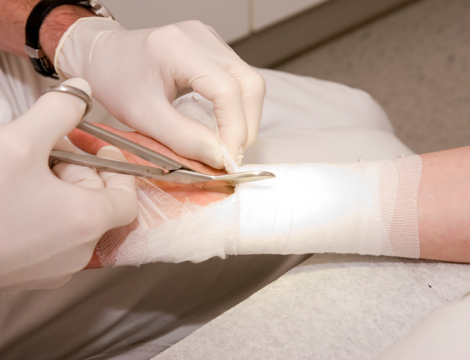 Suivi des plaies et pansements par les pharmaciens : le coup de sang d’un syndicat infirmier