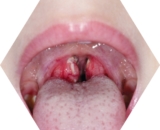 © ARMPL3203_C2_CO-Lesangines.qcd-60-image_I1