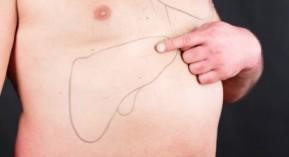 Anti-VHC : 4 spécialités inédites en ville