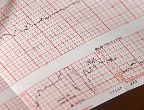 Rémunération : un bilan trimestriel bien pâle et une ROSP génériques versée en mai