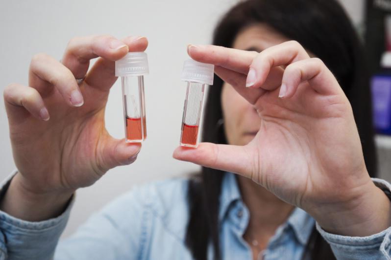 Infirmiers : appel à la création d’un acte de gestion du traitement médicamenteux