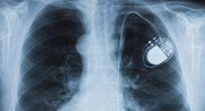 Dispositifs médicaux : un système de contrôle insuffisant