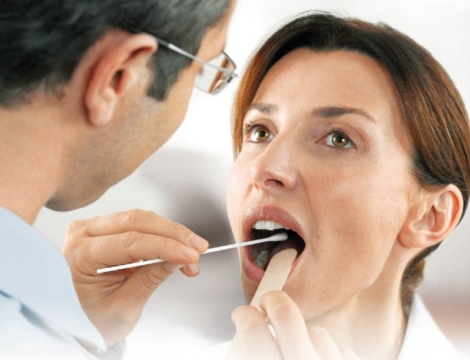 TROD angine : dispensés par le pharmacien et remboursés en 2020