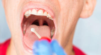 TROD angine : les médecins veulent également être rémunérés