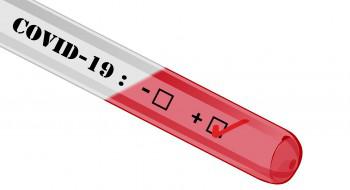 Covid-19 : une plateforme pour obtenir un rendez-vous au laboratoire