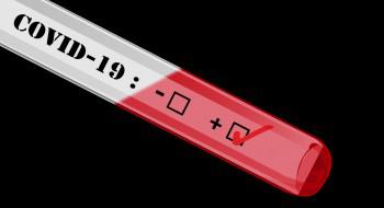 Trod Covid-19 à l’officine : combien êtes-vous à en faire ?