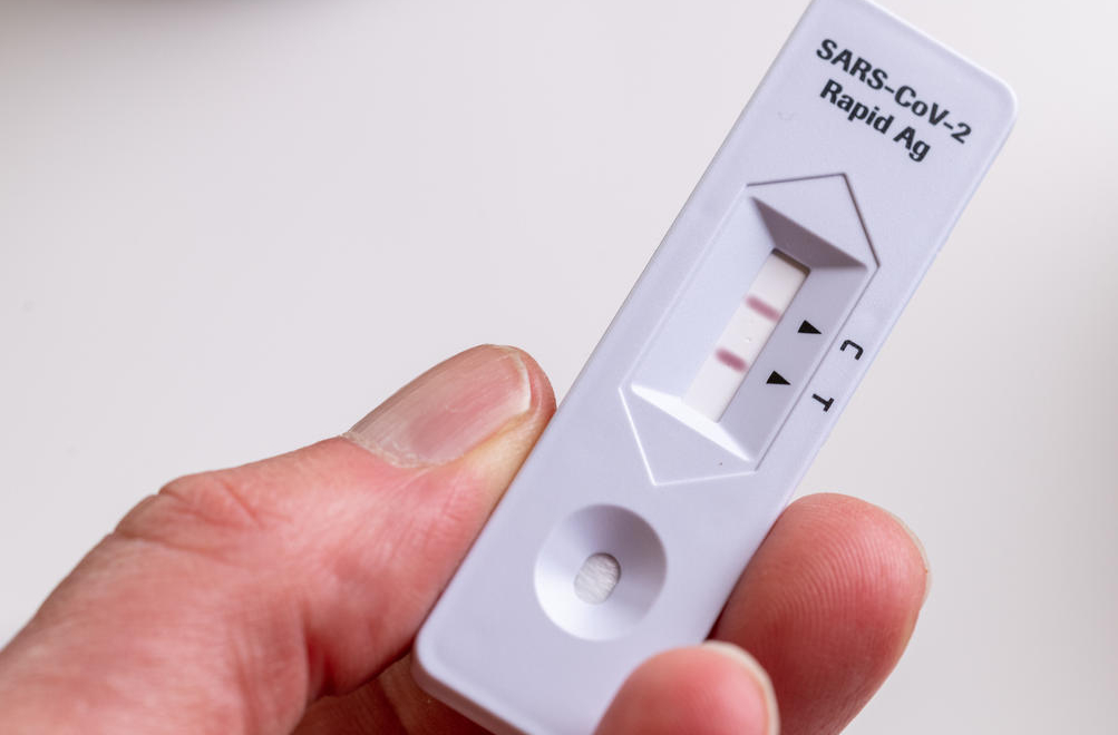 Autotests Covid-19 : un portail pour indiquer son résultat