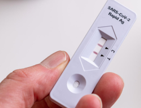 Autotests Covid-19 : un portail pour indiquer son résultat