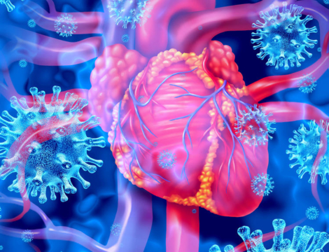 Vaccins anti-Covid-19 : myocardites et Guillain-Barré sur les notices