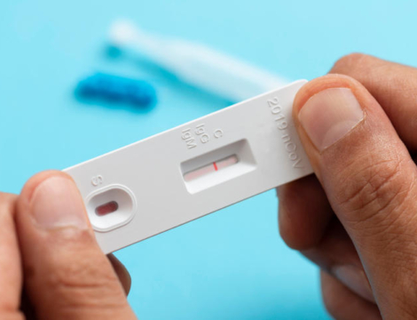 Pass sanitaire : la supervision des autotests en pratique