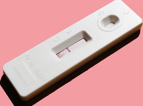 Tests antigéniques : les facturer systématiquement pour éviter le risque d’indus