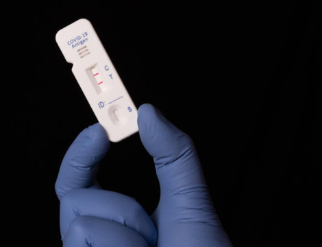 Fin de la gratuité des tests antigéniques Covid-19 : l&rsquo;après 15 octobre se dessine