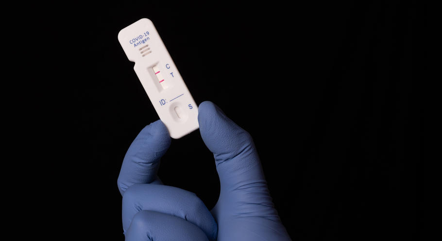 Fin de la gratuité des tests antigéniques Covid-19 : l&rsquo;après 15 octobre se dessine