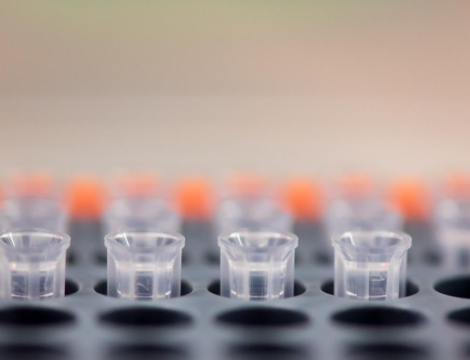 Dépistage du variant Omicron : le dispositif national de séquençage en ordre de bataille