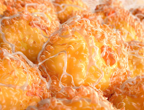 Lipolytiques injectables vendus sur internet : l’ANSM suspend certains produits