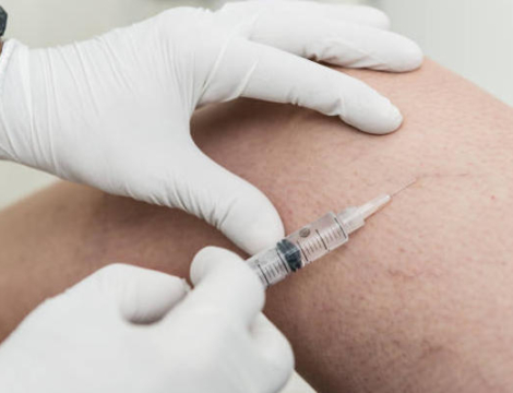 Sclérosants veineux : attention aux effets cardiovasculaires !