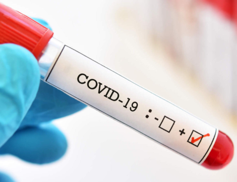 Covid-19 : les tests remboursés coûtent un bras à l’Assurance maladie