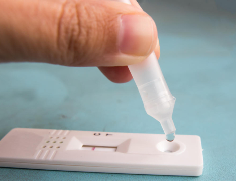 Autotests Covid-19 remboursés en pharmacie à partir de lundi : tous les détails