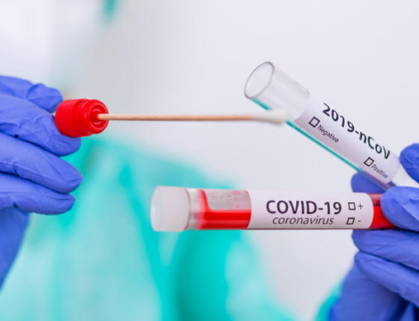 Dépistage Covid-19 : pas de test PCR après un test antigénique positif