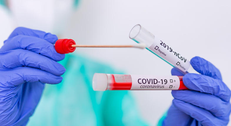 Dépistage Covid-19 : pas de test PCR après un test antigénique positif
