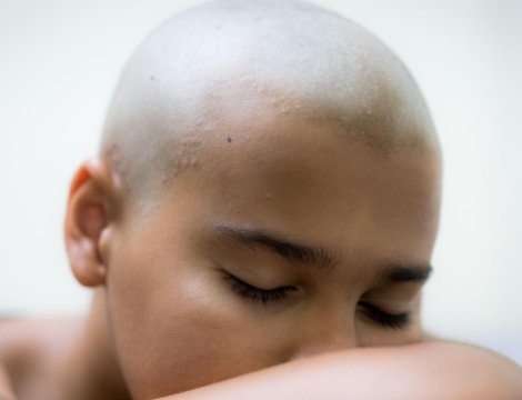 Cancer : les patients attendent plus de conseils de leur pharmacien