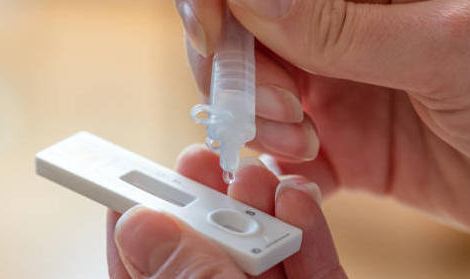 Tests de dépistage Covid-19 : ça  baisse… mais moins vite