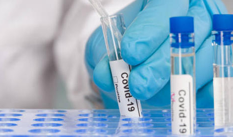 Tests de dépistage Covid-19 : ça repart à la hausse !