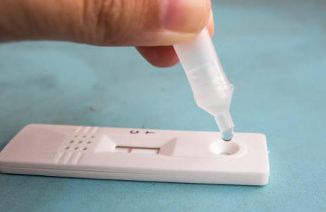 Tests Covid-19 : la baisse s&rsquo;intensifie encore et encore…