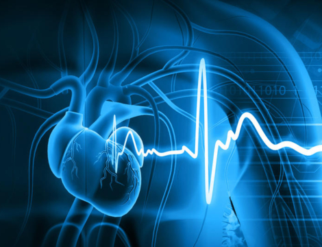 Donépézil : attention à l’allongement de l’intervalle QTc