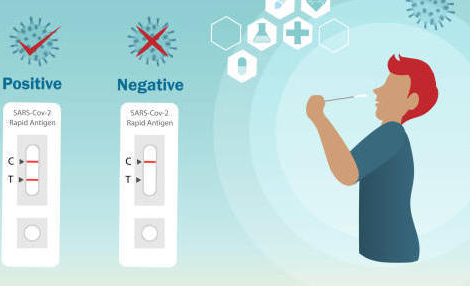 Covid-19 : le nombre de cas positifs déjà en légère hausse