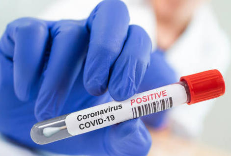 Covid-19 : les contaminations remontent