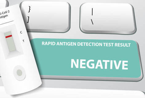 Tests antigéniques Covid-19 : la grève a-t-elle des effets sur leur nombre ?