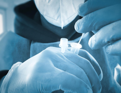 Nouveau tarif des tests antigéniques Covid-19 : du travail à perte ?