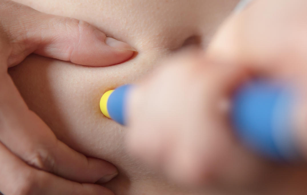 Substitution biosimilaire : quand les stylos pour injection ne sont pas interchangeables