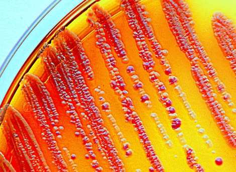 Lutte contre l’antibiorésistance : ce que peut apporter la dispensation à l’unité