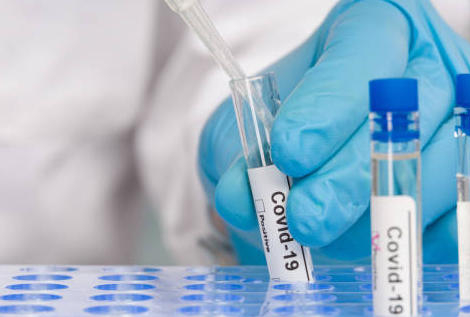 Covid-19 : et le taux de positivité des tests est de…