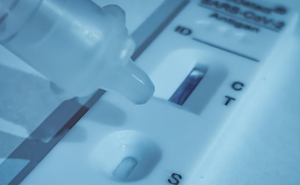 Tests antigéniques Covid-19 : ceux dont l’utilisation est limitée après le 8 juillet