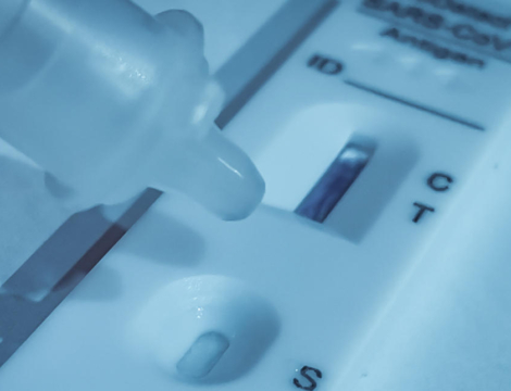 Tests antigéniques Covid-19 : ceux dont l’utilisation est limitée après le 8 juillet